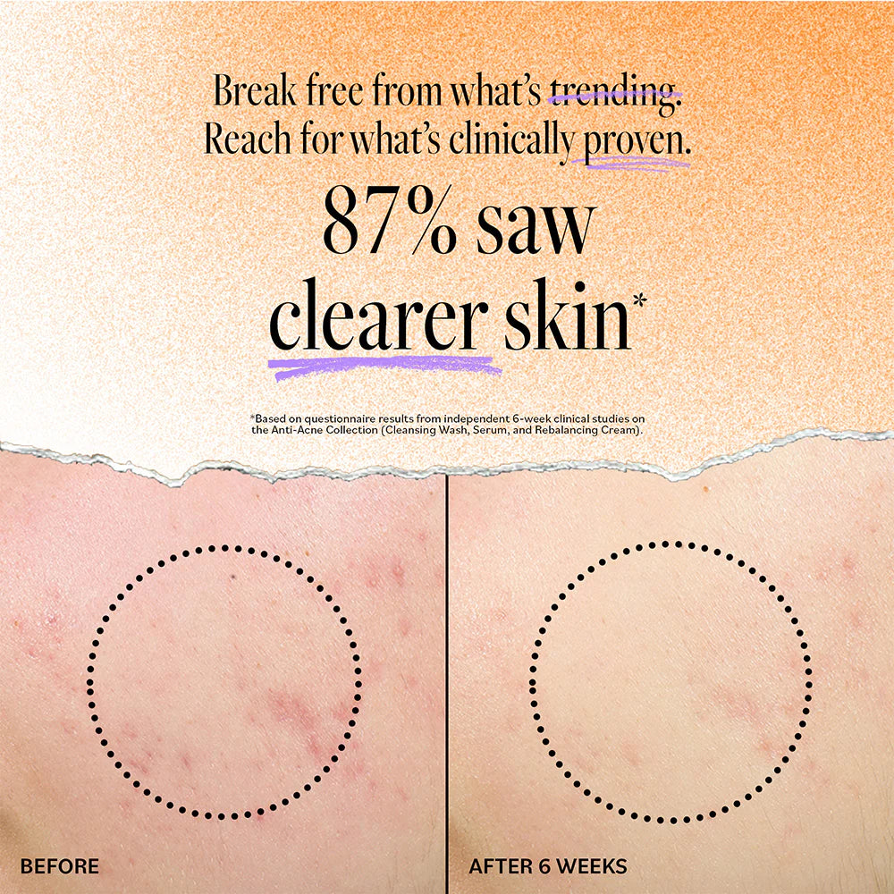 DERMA E ACNE CLEANSING DEEP PORE
